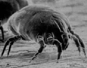 house dust mite allergy